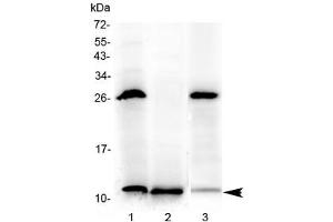 Western blot testing of 1) rat stomach, 2) rat small intestine and 3) mouse small intestine with Tff3 antibody at 0. (TFF3 抗体)