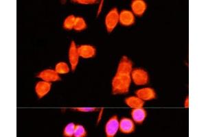 Immunofluorescence analysis of Hela cells using DNAJC19 Polyclonal Antibody at dilution of 1:100 (40x lens). (DNAJC19 抗体)