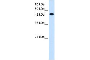 WB Suggested Anti-PTPRR Antibody Titration:  0. (PTPRR 抗体  (C-Term))