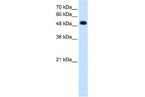 WB Suggested Anti-PTPRR Antibody Titration:  0. (PTPRR 抗体  (C-Term))