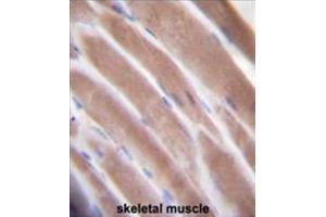 VEGF3 Antibody (N-term) immunohistochemistry analysis in formalin fixed and paraffin embedded human skeletal muscle followed by peroxidase conjugation of the secondary antibody and DAB staining. (VEGFC 抗体  (N-Term))