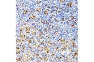 Immunohistochemistry of paraffin-embedded mouse spleen using FLT1 antibody (ABIN6132264, ABIN6140687, ABIN6140689 and ABIN6216515) at dilution of 1:100 (40x lens).