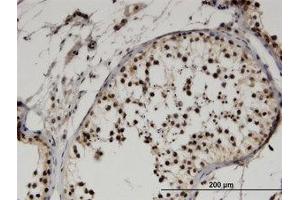 Image no. 2 for anti-F-Box Protein 9 (FBXO9) (AA 338-448) antibody (ABIN599547) (FBXO9 抗体  (AA 338-448))