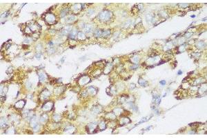 Immunohistochemistry (Paraffin-embedded Sections) (IHC (p)) image for anti-Enoyl Coenzyme A Hydratase 1, Peroxisomal (ECH1) antibody (ABIN7256490)