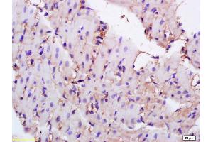 Formalin-fixed and paraffin embedded rat heart labeled with Anti-CD36/PAS-4 Polyclonal Antibody, Unconjugated (ABIN737661) at 1:200 followed by conjugation to the secondary antibody and DAB staining. (CD36 抗体  (AA 51-150))