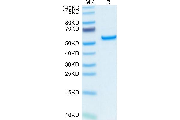 APCS Protein (AA 20-223) (Fc Tag)