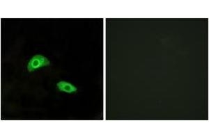 Immunofluorescence analysis of HeLa cells, using GPR174 Antibody. (GPR174 抗体  (AA 126-175))