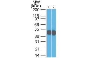 Western Blot Analysis (1) HeLa and (2) A431 lysate using Cytokeratin 18 Mouse Monoclonal Antibody (DC10). (Cytokeratin 18 抗体)