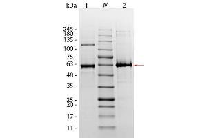 SDS-PAGE of AKT1 (phosphatase treated) Human Recombinant Protein. (AKT1 蛋白)
