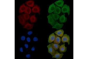 ABIN6259338 and ABIN6275436 staining Hela cells(45 min of heat-shock) by IF/ICC. (RAB3GAP2 抗体  (Internal Region))