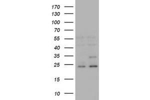 Image no. 4 for anti-RAB21, Member RAS Oncogene Family (RAB21) antibody (ABIN1500547) (RAB21 抗体)
