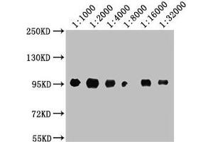 Western Blot Positive WB detected in: A549 whole cell lysate All lanes: CD44 antibody at 1:1000, 1:2000, 1:4000, 1:8000, 1:16000, 1:32000 Secondary Goat polyclonal to Mouse IgG at 1/10000 dilution Predicted band size: 82, 4, 78, 77, 81, 79, 75, 54,47, 40, 44, 33, 74, 76, 38, 16 kDa Observed band size: 95 kDa (CD44 抗体  (AA 21-220))