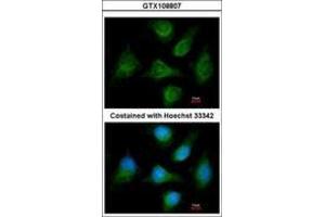 Image no. 2 for anti-Calcium Channel, Voltage-Dependent, beta 1 Subunit (CACNB1) (AA 360-523) antibody (ABIN467509) (CACNB1 抗体  (AA 360-523))
