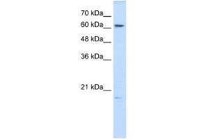WB Suggested Anti-GPX3 Antibody Titration:  0. (GPX3 抗体  (N-Term))