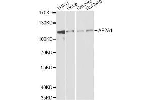 Western blot analysis of extracts of various cell lines, using AP2A1 antibody. (alpha Adaptin 抗体)