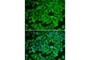 Immunofluorescence analysis of U2OS cells using NR0B1 antibody (ABIN5970870). (NR0B1 抗体)