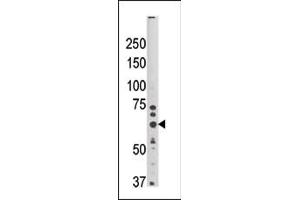 Western blot analysis of anti-HRD1 Pab (ABIN1882139 and ABIN2837883) in mouse brain tissue lysate (35 μg/lane).