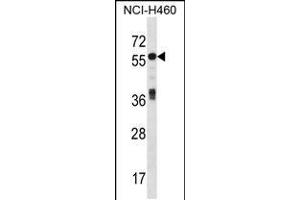 Western blot analysis in NCI-H460 cell line lysates (35ug/lane). (ICA1 抗体  (N-Term))