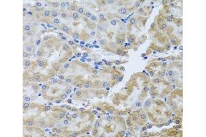 Immunohistochemistry of paraffin-embedded Rat kidney using PER1 Polyclonal Antibody at dilution of 1:100 (40x lens). (PER1 抗体)
