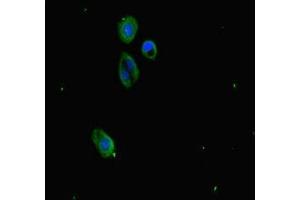 Immunofluorescence staining of HepG2 cells with ABIN7163811 at 1:333, counter-stained with DAPI. (SUZ12 抗体  (AA 131-305))