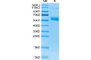SDS-PAGE (SDS) image for Plasmalemma Vesicle Associated Protein (PLVAP) (AA 49-442) protein (His tag) (ABIN7275502)