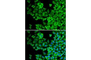Immunofluorescence analysis of A549 cell using HCK antibody. (HCK 抗体)