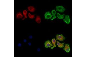 Citrate synthetase Antibody staining Hela cells by IF/ICC. (Citrate Synthetase (C-Term) 抗体)