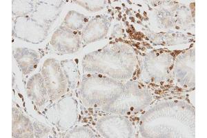 IHC-P Image Immunohistochemical analysis of paraffin-embedded human lymphocytes in gastric epithelium, using HCLS1, antibody at 1:100 dilution. (HCLS1 抗体  (C-Term))