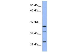 WB Suggested Anti-SOX21 Antibody Titration: 0. (SOX21 抗体  (Middle Region))