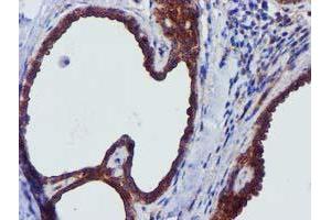 Immunohistochemical staining of paraffin-embedded Human breast tissue using anti-EPN2 mouse monoclonal antibody. (Epsin 2 抗体)