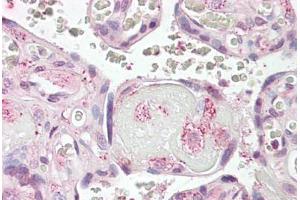 Anti-LYN antibody IHC staining of human placenta. (LYN 抗体  (AA 39-58))