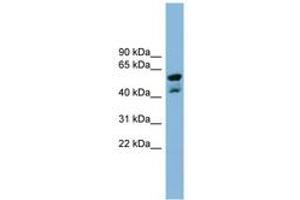Image no. 1 for anti-Protein Phosphatase Methylesterase 1 (PPME1) (N-Term) antibody (ABIN6742049) (PPME1 抗体  (N-Term))
