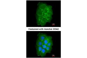 AP31081PU-N CAV2 antibody staining of Paraformaldehyde-Fixed A431 by Immunofluorescence at 1/200 dilution. (Caveolin 2 抗体  (AA 1-45))