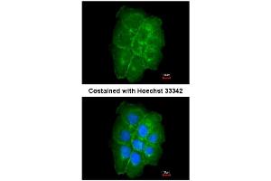 AP31081PU-N CAV2 antibody staining of Paraformaldehyde-Fixed A431 by Immunofluorescence at 1/200 dilution. (Caveolin 2 抗体  (AA 1-45))