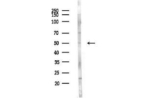 Western blot analysis of lysates from  cells(starvation,24h treatment), using IL6R Antibody at 1/1000 dilution.