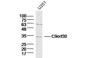 Lane 1: U251 lysates probed with C9orf30 Polyclonal Antibody, Unconjugated  at 1:300 overnight at 4˚C. (MSANTD3 抗体  (AA 1-100))