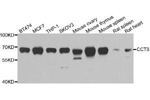 Western blot analysis of extracts of various cell lines, using CCT3 antibody. (CCT3 抗体)