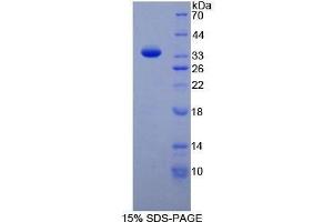 SDS-PAGE (SDS) image for TAF1 RNA Polymerase II, TATA Box Binding Protein (TBP)-Associated Factor (TAF1) (AA 1379-1636) protein (His tag) (ABIN2126927)