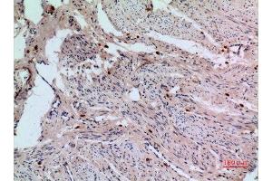 Immunohistochemistry (IHC) analysis of paraffin-embedded Human Uterus, antibody was diluted at 1:100.