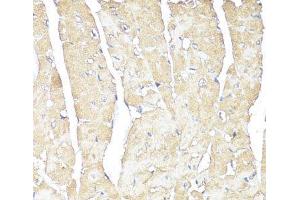 Immunohistochemistry (Paraffin-embedded Sections) (IHC (p)) image for anti-ATPase, Na+/K+ Transporting, beta 1 Polypeptide (ATP1B1) antibody (ABIN7257517)