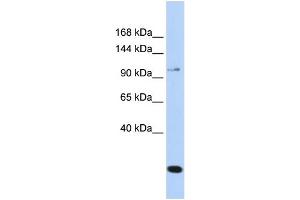 WB Suggested Anti-TRPC6 Antibody Titration: 0. (TRPC6 抗体  (N-Term))