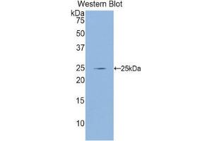 Western Blotting (WB) image for anti-Glutamate-Cysteine Ligase, Catalytic Subunit (GCLC) (AA 435-636) antibody (ABIN1858973)