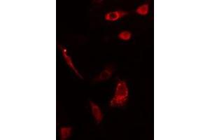 ABIN6275561 staining HepG2 cells by IF/ICC. (SH2D2A 抗体  (C-Term))