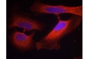 Immunofluorescence staining of methanol-fixed HeLa cells using Keratin 8 (Phospho-Ser74) Antibody (E011307, Red) (KRT8 抗体  (pSer74))