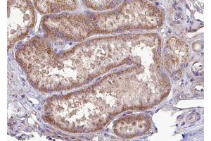 ABIN6272980 at 1/100 staining Mouse kidney tissue by IHC-P. (SEC61G 抗体  (Internal Region))