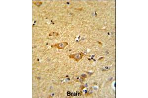 Formalin-fixed and paraffin-embedded human brain reacted with OMD Antibody , which was peroxidase-conjugated to the secondary antibody, followed by DAB staining. (Osteomodulin 抗体  (AA 234-263))