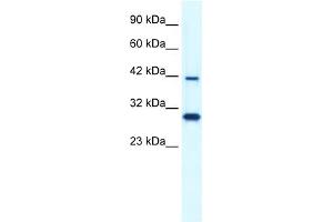 WB Suggested Anti-PREB Antibody Titration:  0. (PREB 抗体  (N-Term))