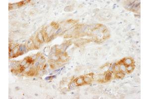 Immunohistochemistry (IHC) image for anti-Eukaryotic Translation Elongation Factor 1 gamma (EEF1G) (AA 200-250) antibody (ABIN7454671)