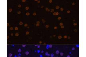 Immunofluorescence analysis of Mouse brain using MEF2C Polyclonal Antibody at dilution of 1:100 (40x lens). (MEF2C 抗体)