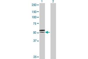 Western Blot analysis of GGT6 expression in transfected 293T cell line by GGT6 MaxPab polyclonal antibody. (gGT6 抗体  (AA 1-493))